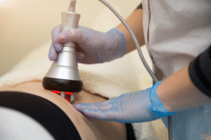 reducción corporal: tipos de tratamientos